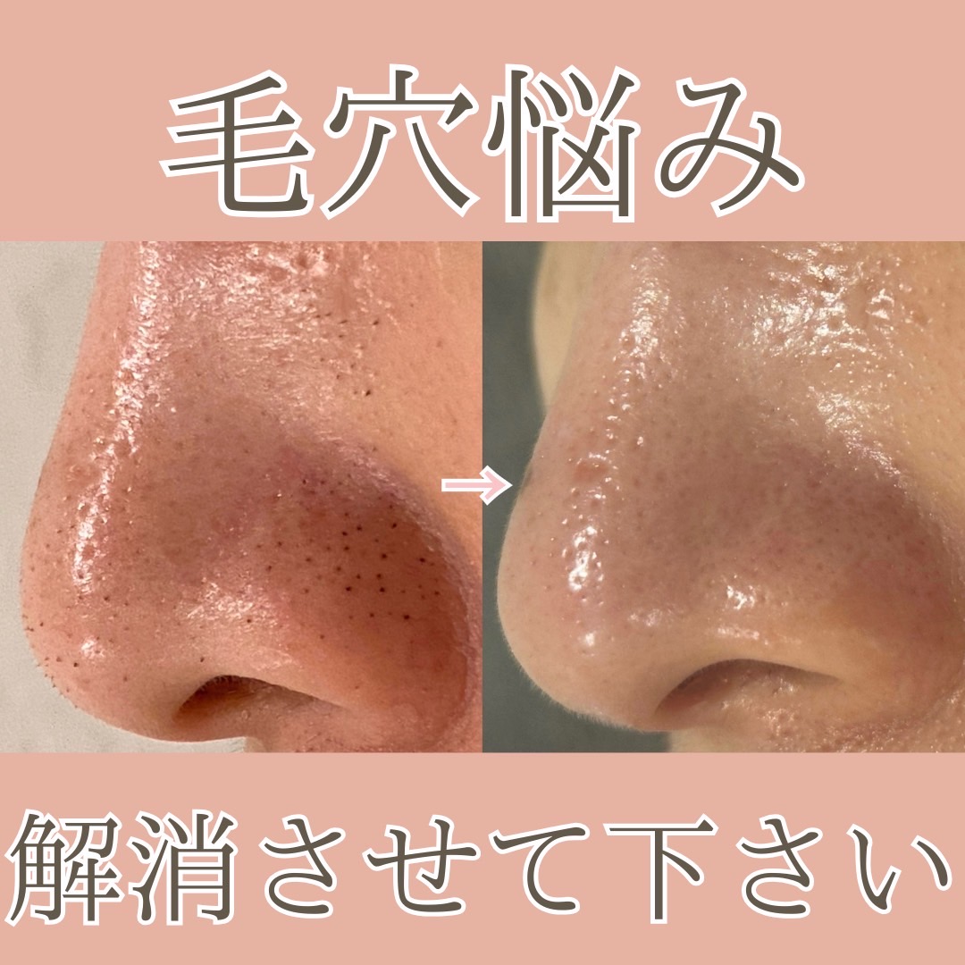 【阪急茨木市駅】≪エステ実務経験のある方優遇≫≪未経験OK≫≪週3日、1日6時間～OK≫≪社会保険完備≫エステティシャン兼アイリストとして勤務出来る方歓迎！希望があればまつエクやまつ毛パーマも学べる！シミ取りや痩身の脂肪冷却メニューが人気な「肌質改善サロン La chou chou（ハダシツカイゼンサロンラシュシュ）」からエステティシャンの求人★☆★