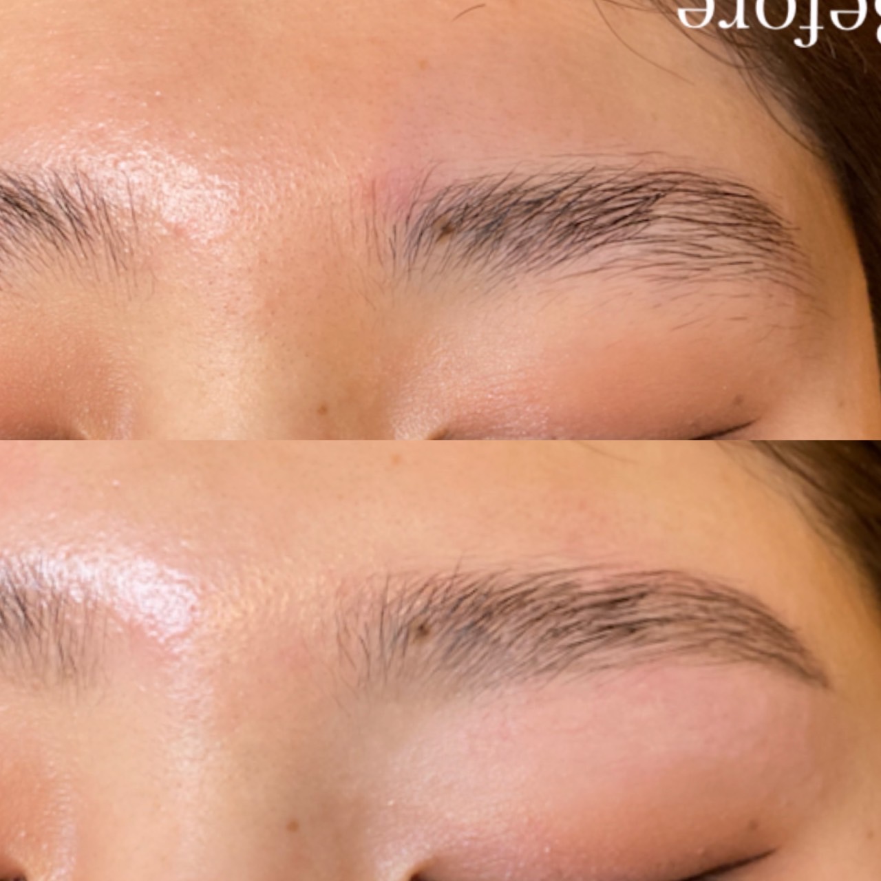 【阪急茨木市駅】≪エステ実務経験のある方優遇≫≪未経験OK≫≪週3日、1日6時間～OK≫≪社会保険完備≫エステティシャン兼アイリストとして勤務出来る方歓迎！希望があればまつエクやまつ毛パーマも学べる！シミ取りや痩身の脂肪冷却メニューが人気な「肌質改善サロン La chou chou（ハダシツカイゼンサロンラシュシュ）」からエステティシャンの求人★☆★