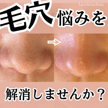 肌質改善サロン La chou chou（ハダシツカイゼンサロン ラ シュ シュ）