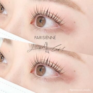 Gemmy eye（ジェミーアイ）