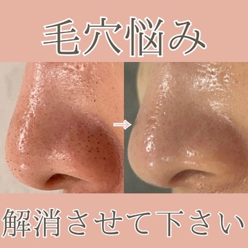 【阪急茨木市駅】≪エステ実務経験のある方優遇≫≪未経験OK≫≪週3日、1日6時間～OK≫≪社会保険完備≫エステティシャン兼アイリストとして勤務出来る方歓迎！希望があればまつエクやまつ毛パーマも学べる！シミ取りや痩身の脂肪冷却メニューが人気な「肌質改善サロン La chou chou（ハダシツカイゼンサロンラシュシュ）」からエステティシャンの求人★☆★