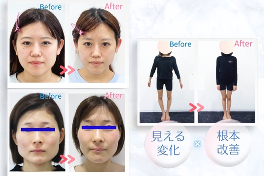 【小倉】≪未経験男女歓迎≫≪社会保険完備≫≪研修お祝い金の支給あり≫≪客単価11000円以上≫業界トップクラス高待遇＆全国に店舗拡大中の美容矯正専門サロン！20～30代女性のお客様が中心に人気の小顔矯正や骨盤矯正技術が習得可能！「株式会社ブラスト 小倉店（カブシキガイシャブラストコクラテン）」からセラピストの求人★☆